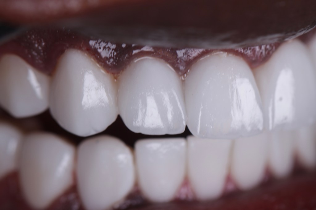 Smile Infinity Medical Center Horch Tabet Beirut dental clinic