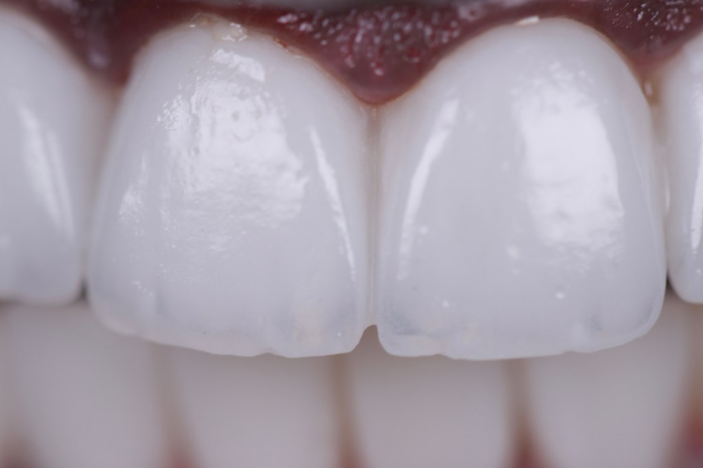 Smile Infinity Lebanon treatment room