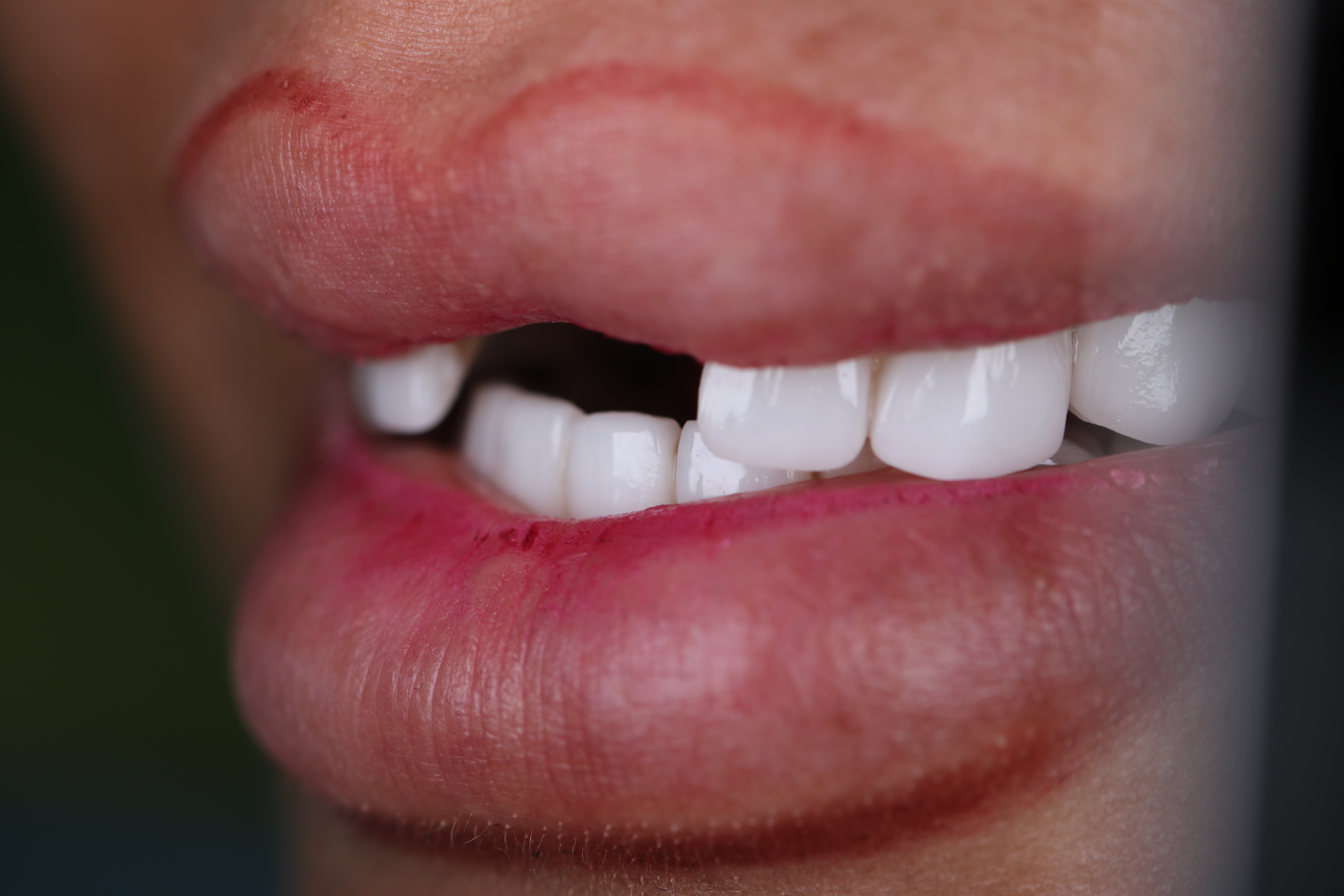 Smile Infinity Medical Center luxury clinic interior, Beirut, Lebanon