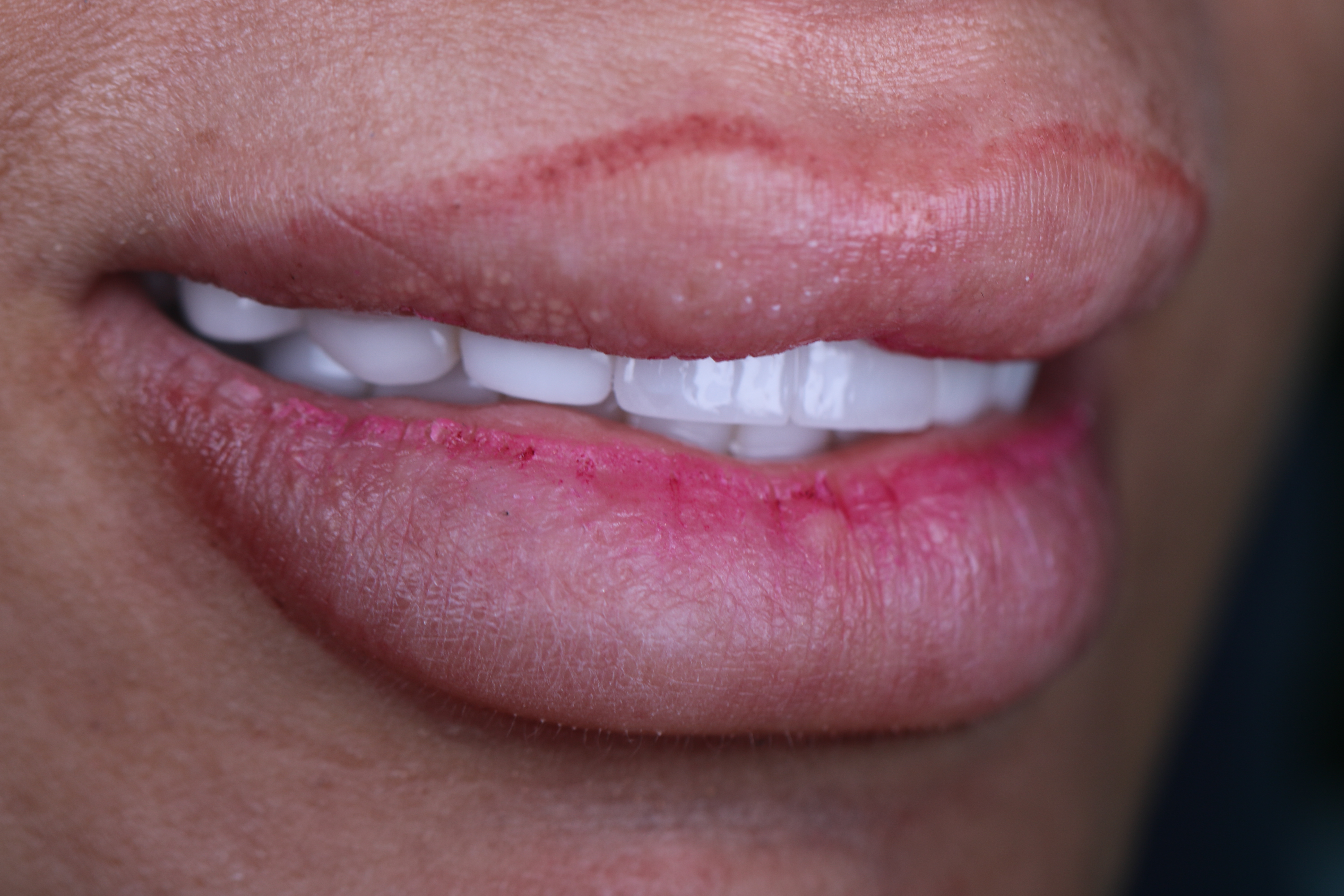Smile Infinity Medical Center treatment room interior, Beirut, Lebanon &mdash; Dr. Habib Zarifeh