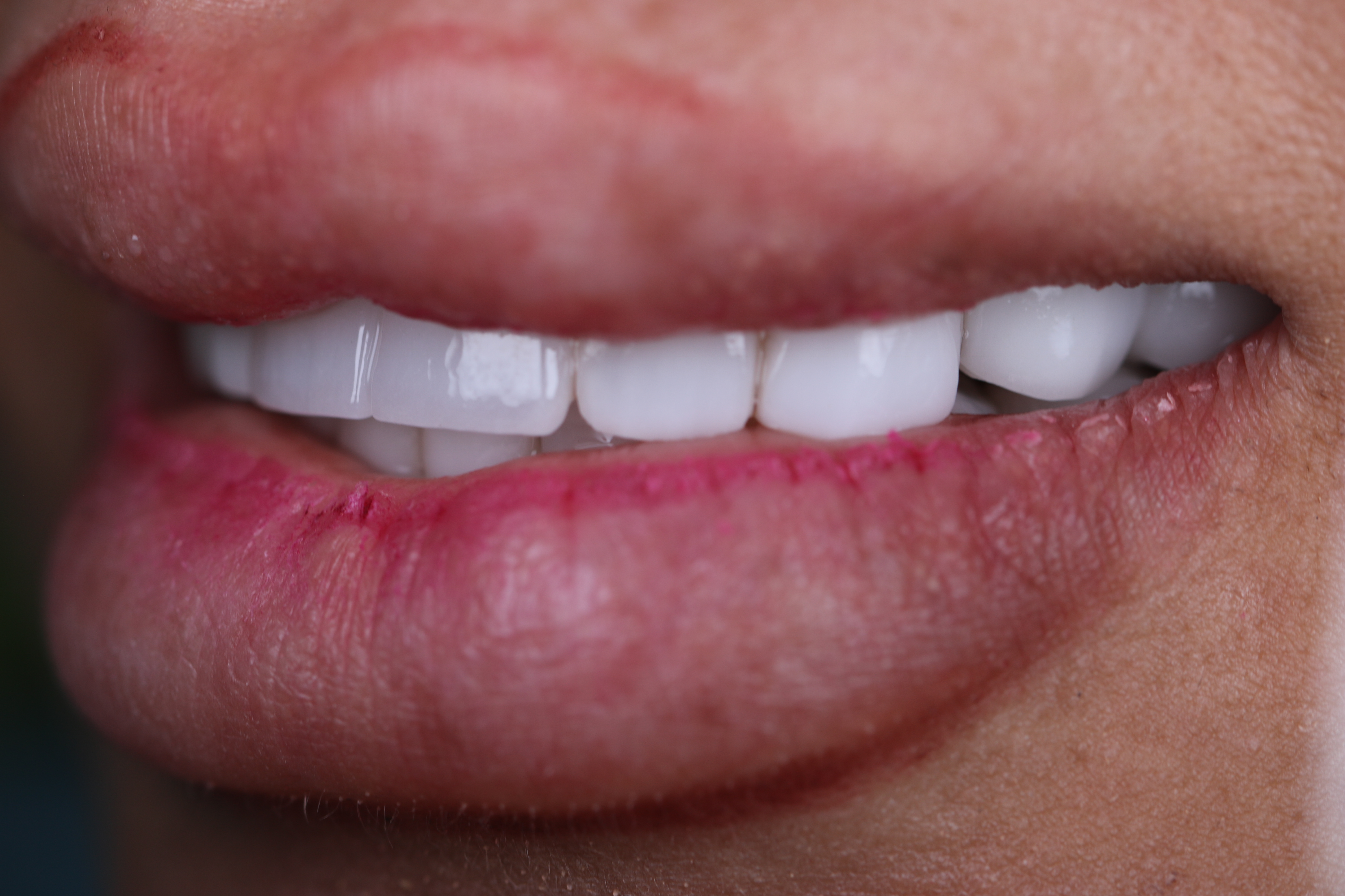 Smile Infinity Medical Center Beirut dental clinic treatment room interior, Lebanon
