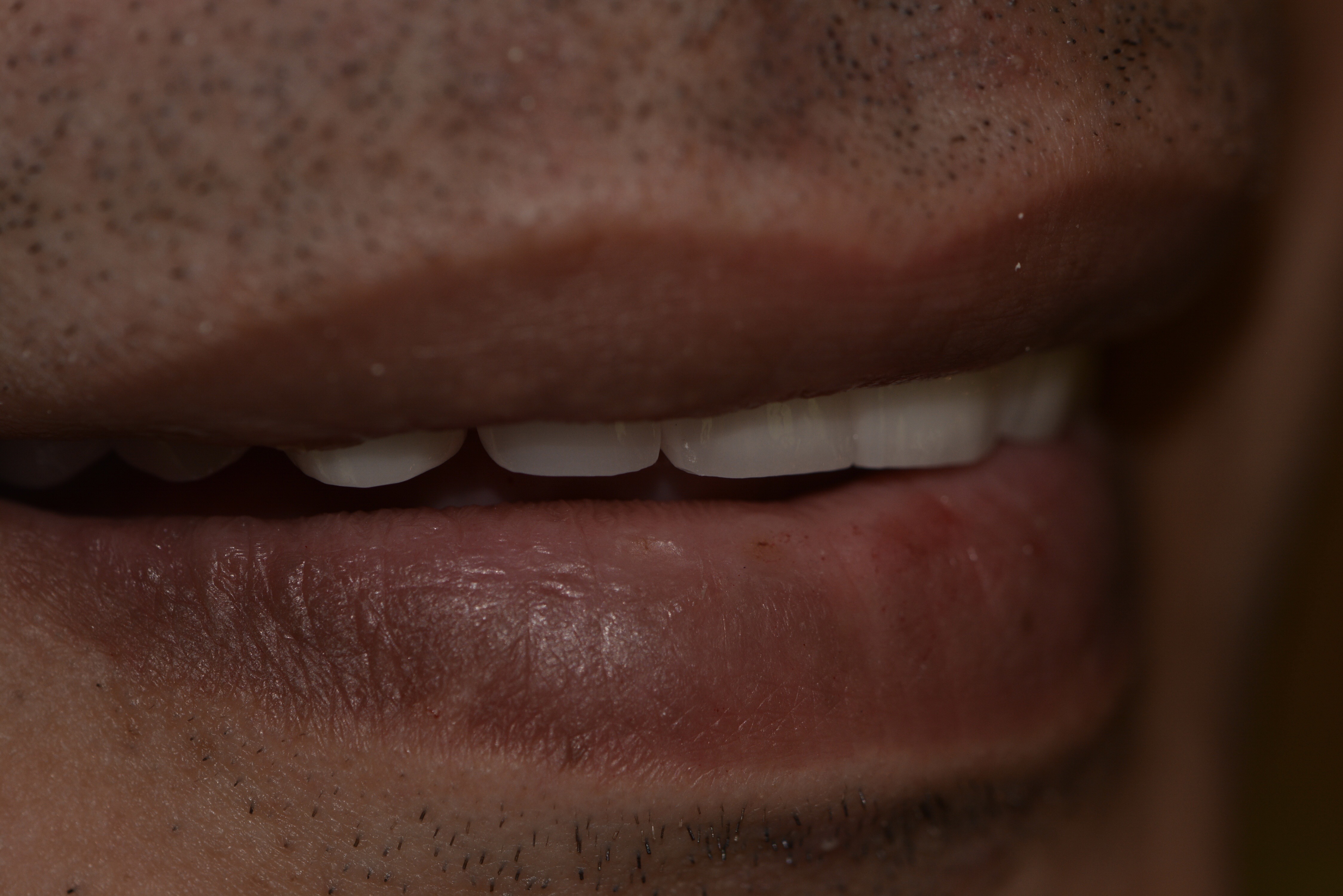 Dr Habib Zarifeh portrait implantologist Beirut Lebanon Smile Infinity One Day Implant