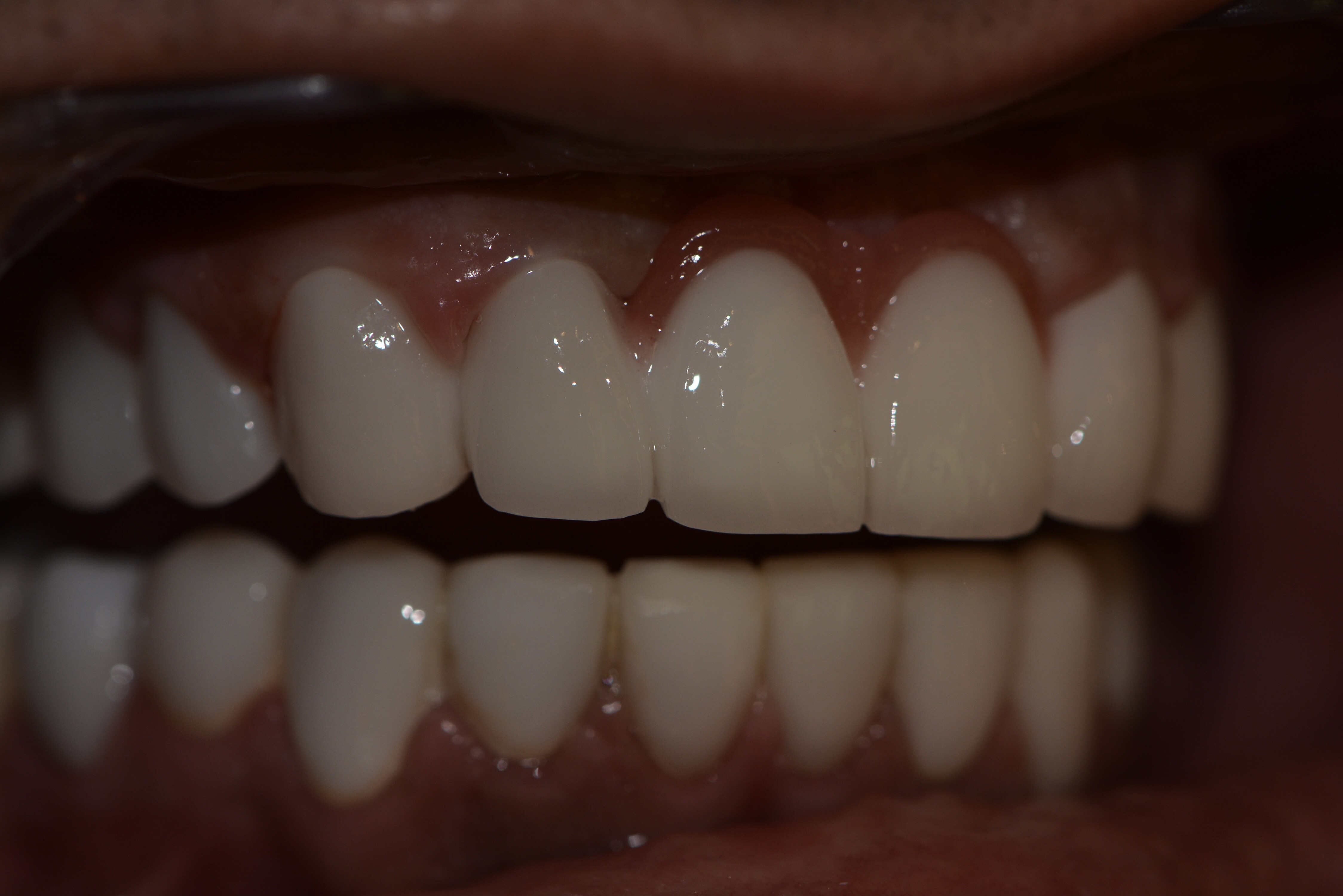 Dr Habib Zarifeh portrait dental implants Lebanon Beirut oral surgeon