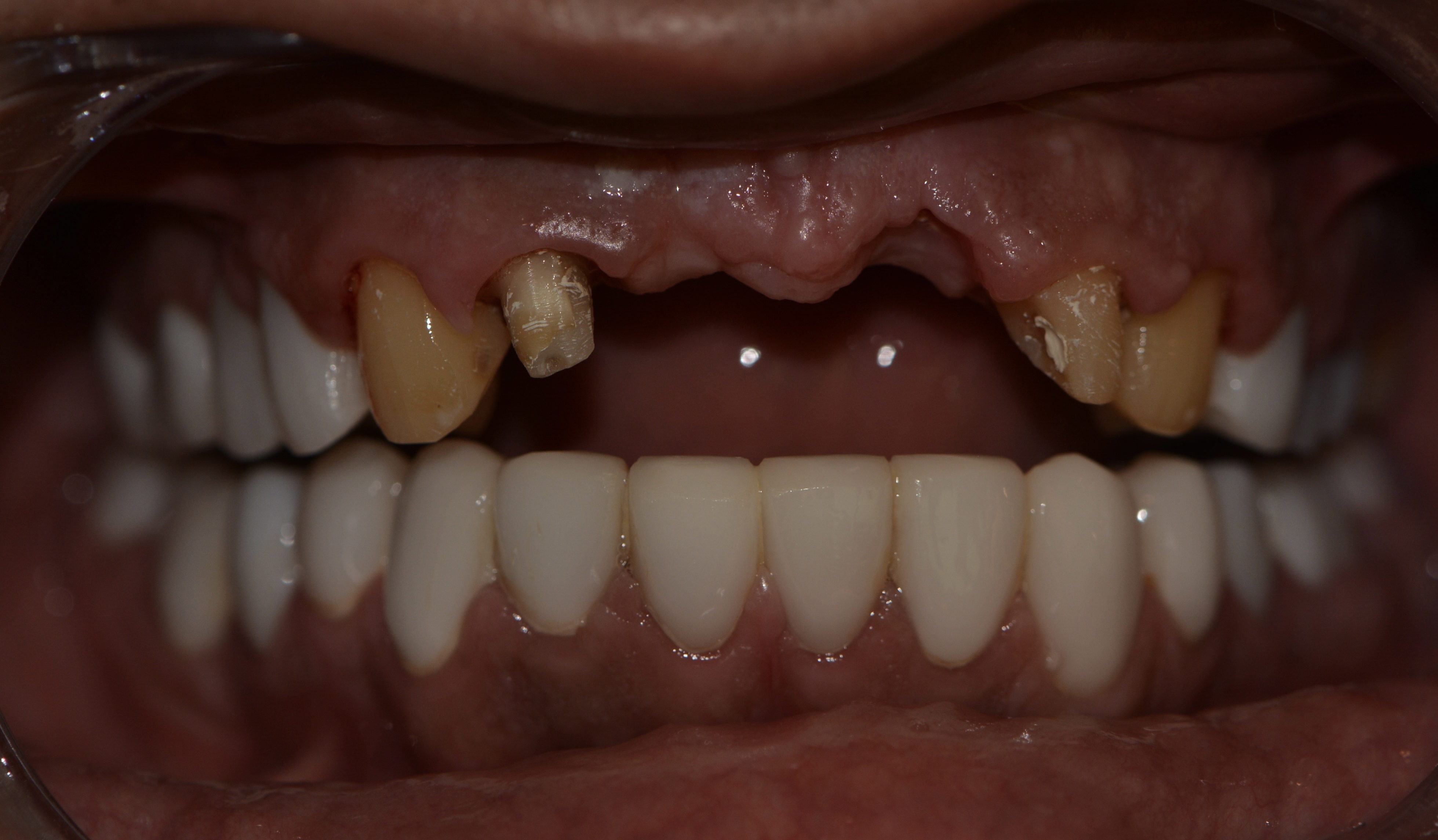 Dr Habib Zarifeh full length portrait oral surgeon Beirut Lebanon